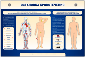 Электрифицированный стенд-тренажер "Остановка кровотечения" - fgospostavki.ru - Касимов